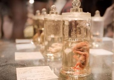 烟台试管婴儿的费用是多少？