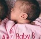 取卵前还是取卵后做宫腔粘连手术？