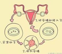 死精率80%的男性可以在霍林郭勒市做三代试管吗？公开2026做三代试管条件